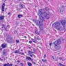 Histopathology patch