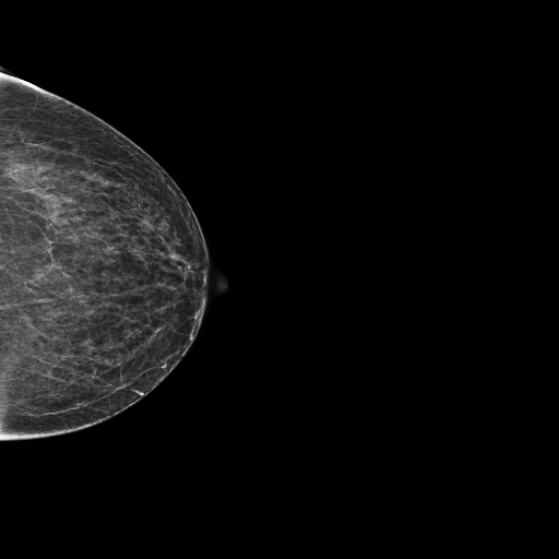 benign case